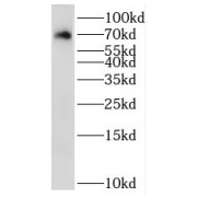 WB analysis of mouse kidney tissue, using RAB11FIP5 antibody (1/500 dilution).