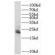 WB analysis of human testis tissue, using RAB18 antibody (1/800 dilution).