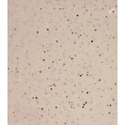 Ras-Related Protein Rab-2A (RAB2A) Antibody