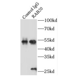 RAB20, Member RAS Oncogene Family (RAB20) Antibody