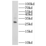 WB analysis of SW 1990 cells, using RAB20 antibody (1/1000 dilution).