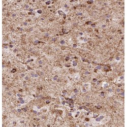 RAB22A, Member RAS Oncogene Family (RAB22A) Antibody