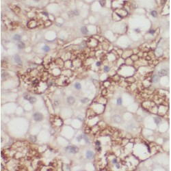 RAB23, Member RAS Oncogene Family (Rab23) Antibody