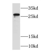 WB analysis of mouse brain tissue, using RAB23 antibody (1/1000 dilution).