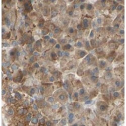 RAB27B, Member RAS Oncogene Family (RAB27B) Antibody