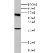 WB analysis of MCF7 cells, using RAB27B antibody (1/1000 dilution).