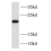 WB analysis of human placenta tissue, using RAB31 antibody (1/300 dilution).