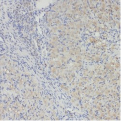 RAB34, Member RAS Oncogene Family (RAB34) Antibody