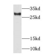 WB analysis of mouse brain tissue, using RAB39 antibody (1/2000 dilution).