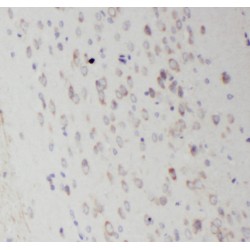 Ras-Related protein Rab-35 (RAB35) Antibody