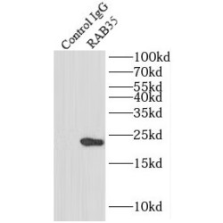 Ras-Related protein Rab-35 (RAB35) Antibody