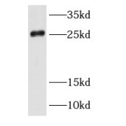 WB analysis of human brain tissue, using RAB35 antibody (1/600 dilution).