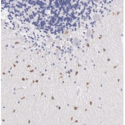 Ras-Related Protein Rab-37 (RAB37) Antibody