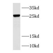 WB analysis of Sp2/0 cells, using RAB37 antibody (1/100 dilution).