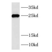 WB analysis of fetal human brain tissue, using RAB39B antibody (1/1000 dilution).