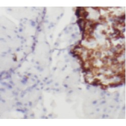 RAB3A-specific Antibody