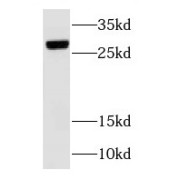 WB analysis of mouse lung tissue, using RAB3C antibody (1/1000 dilution).