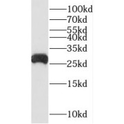 WB analysis of mouse lung tissue, using RAB3D antibody (1/1200 dilution).