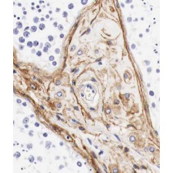 RAB3 GTPase Activating Protein Catalytic Subunit 1 (RAB3GAP1) Antibody