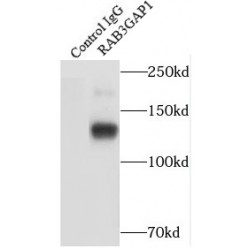 RAB3 GTPase Activating Protein Catalytic Subunit 1 (RAB3GAP1) Antibody