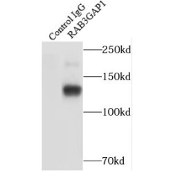 RAB3 GTPase Activating Protein Catalytic Subunit 1 (RAB3GAP1) Antibody