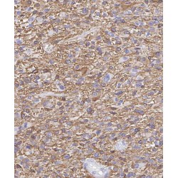 RAB40B, Member RAS Oncogene Family (RAB40B) Antibody