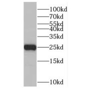 WB analysis of PC-3 cells, using RAB41 antibody (1/1000 dilution).