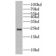 WB analysis of human brain tissue, using RAB43 antibody (1/3000 dilution).