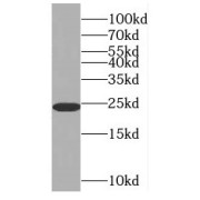 WB analysis of mouse brain tissue, using RAB6A antibody (1/1500 dilution).