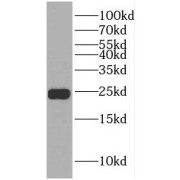 WB analysis of mouse brain tissue, using RAB6B antibody (1/1000 dilution).