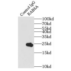 Ras-Related Protein Rab-8A (RAB8A) Antibody