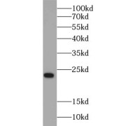 WB analysis of HeLa cells, using RAB8A antibody (1/1000 dilution).