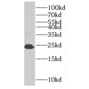 WB analysis of mouse skin tissue, using RAB8B antibody (1/1000 dilution).