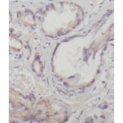 RAB9A, Member RAS Oncogene Family (RAB9A) Antibody