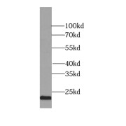 WB analysis of HEK-293 cells, using RAB9A-Specific antibody (1/500 dilution).