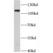 WB analysis of K-562 cells, using ZFYVE20 antibody (1/1000 dilution).