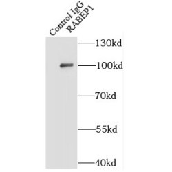 Rabaptin, RAB GTPase Binding Effector Protein 1 (RABEP1) Antibody