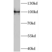 WB analysis of HeLa cells, using RABEP1 antibody (1/400 dilution).