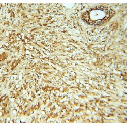 Rabaptin, RAB GTPase Binding Effector Protein 2 (RABEP2) Antibody