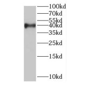 WB analysis of HeLa cells, using RABEPK antibody (1/1000 dilution).