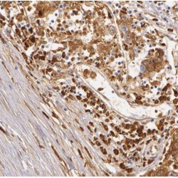 Rab GTPase-Activating Protein 1-Like, Isoform 10 (RABGAP1L) Antibody