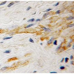 Rab5 GDP/GTP Exchange Factor (RABGEF1) Antibody