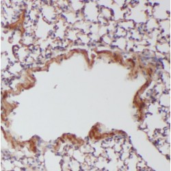 Geranylgeranyl Transferase Type-2 Subunit Alpha (RABGGTA) Antibody