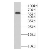 WB analysis of human brain tissue, using RABGGTA antibody (1/500 dilution).