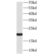 WB analysis of Jurkat cells, using RAC2 antibody (1/10000 dilution).