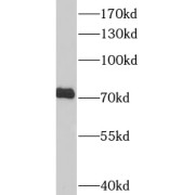 WB analysis of PC-12 cells, using RACGAP1 antibody (1/600 dilution).