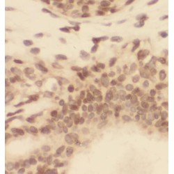 RAD17 Checkpoint Clamp Loader Component (RAD17) Antibody