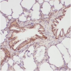 RAD18, E3 Ubiquitin Protein Ligase (RAD18) Antibody