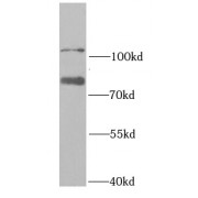 WB analysis of HeLa cells, using RAD18 antibody (1/1000 dilution).