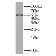 WB analysis of Jurkat cells, using RAD23A antibody (1/500 dilution).